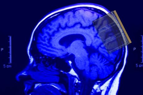 brain scan