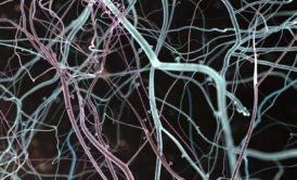 a close-up view of intertwined branches, symbolizing the complexity of neuroplasticity practice and growth