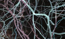 close up of red and blue neurons